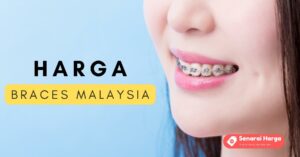 senarai harga braces malaysia terkini