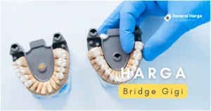 senarai harga bridge gigi malaysia terkini